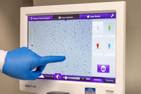 A gloved finger points at a computer display of mouse cortical neurons growing in primary brain cell cultures.]