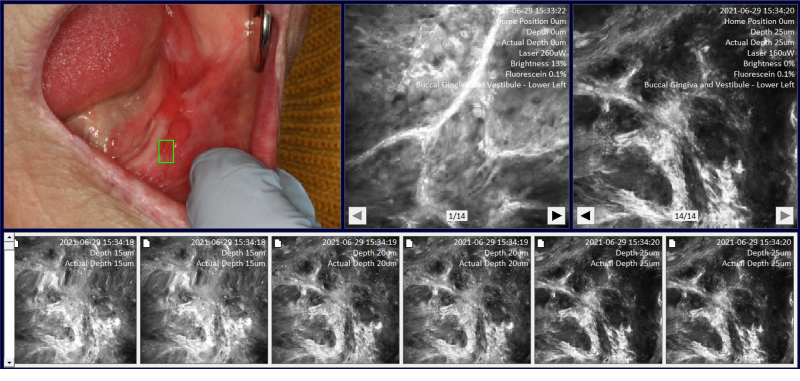 Imagery taken from the MouthMap software. The images are black and white, resembling microscopy images.